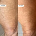 OneSkin BODY OS-01 Peptide Topical Supplement & Skin Longevity Age Reversal Moisturizer | Safe for Sensitive Skin, Fragrance-Free - Image 5